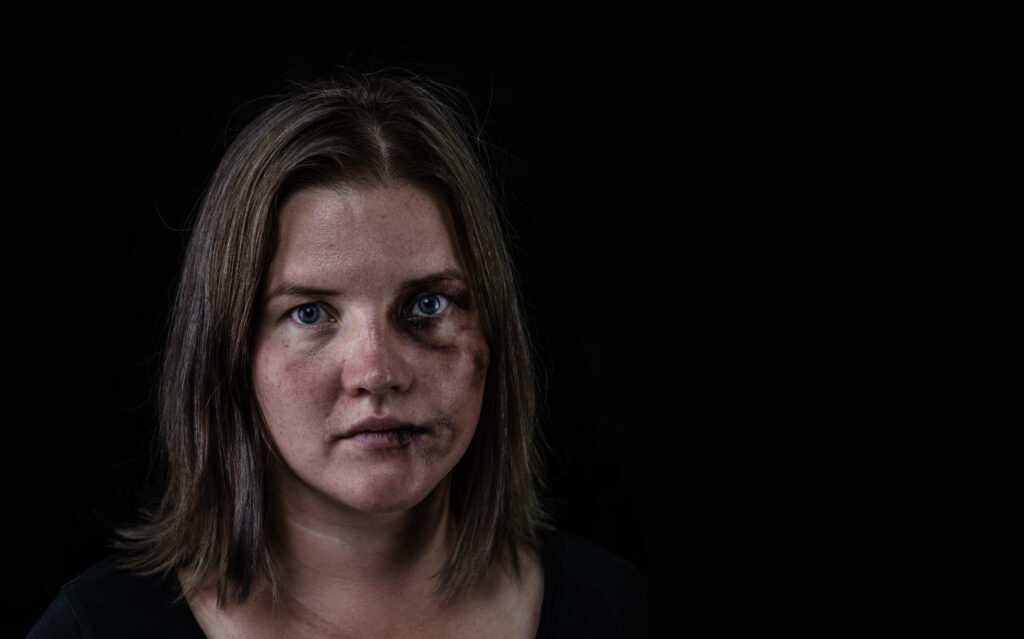 Violência contra a mulher - Adobe Stock